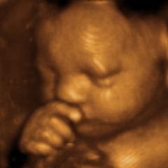 Kamryn Thinking Cropped_medium